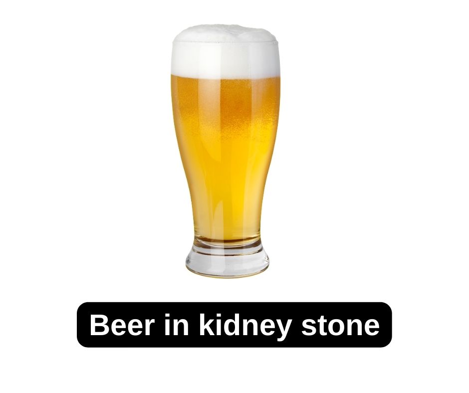 Beer in kidney stone