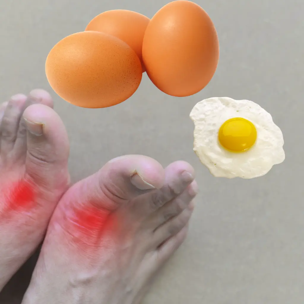 Eggs and Gout